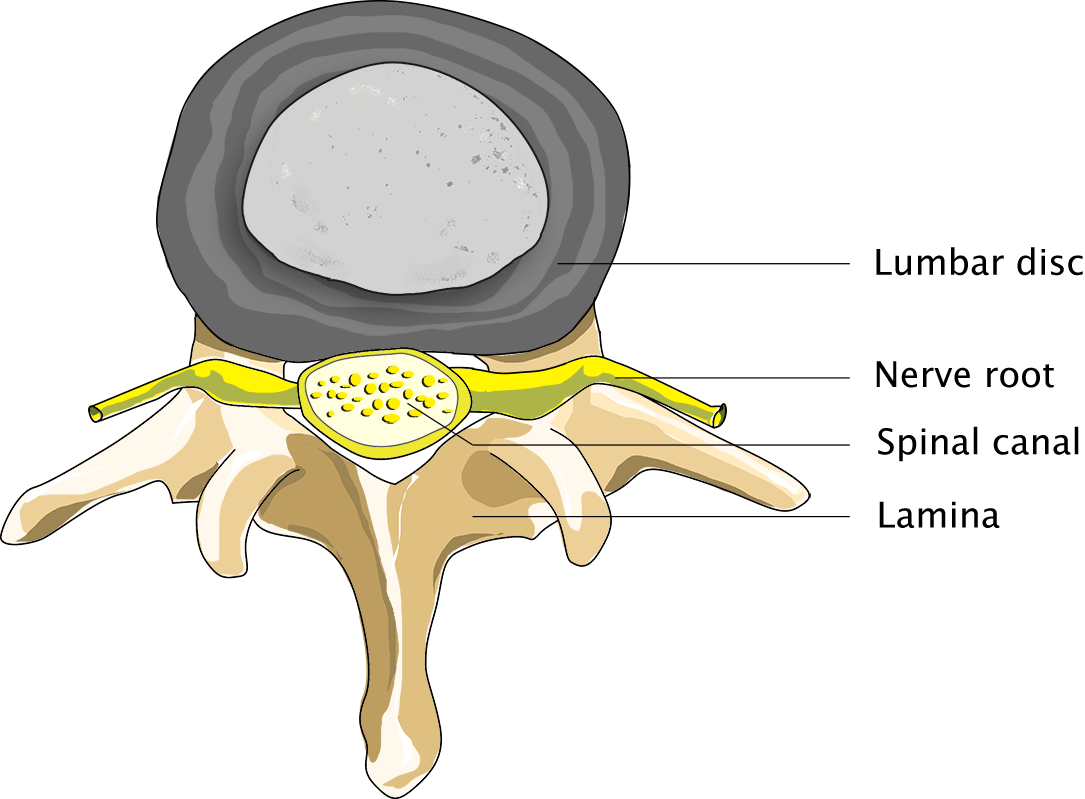 Normal back